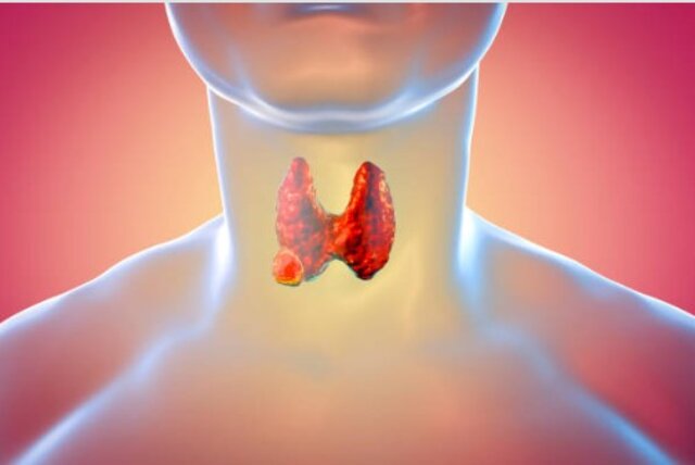 Managing Thyroid Disorders: A practical approach